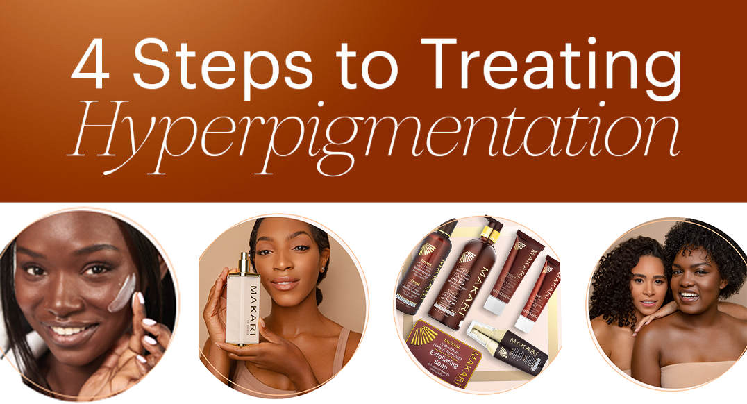 👋 Verabschieden Sie sich mit diesen Schritten von dunklen Flecken