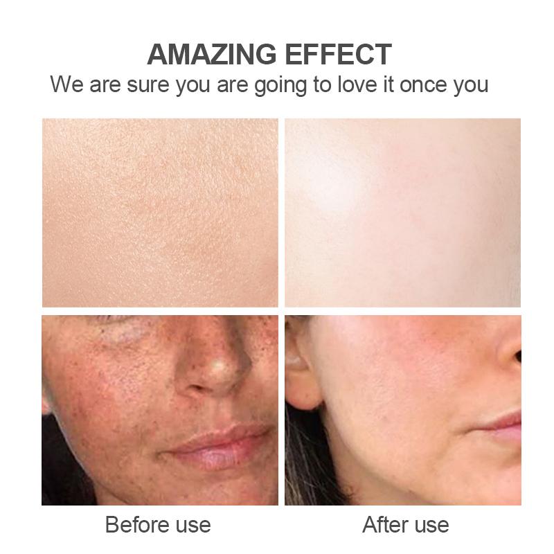 Nettoyant visage naturel au kojic