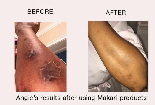 Les produits Makari sont-ils uniquement destinés à l'éclaircissement de la peau ?